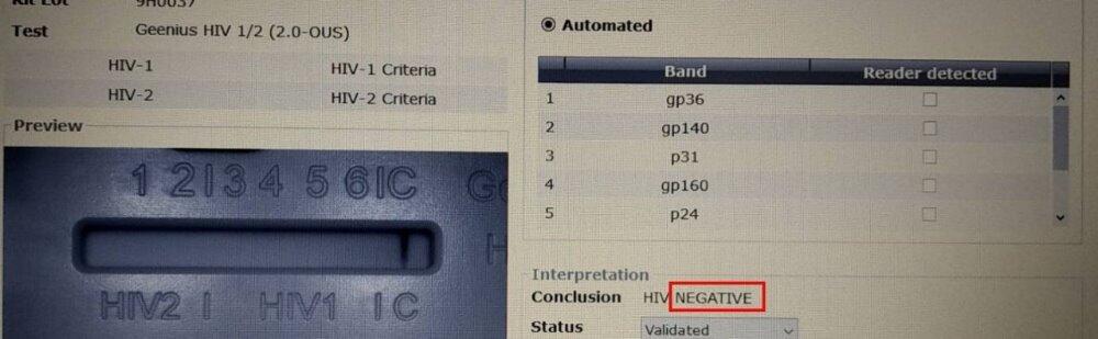 愛滋病HIV篩檢 - 北大醫事X光檢驗所 3