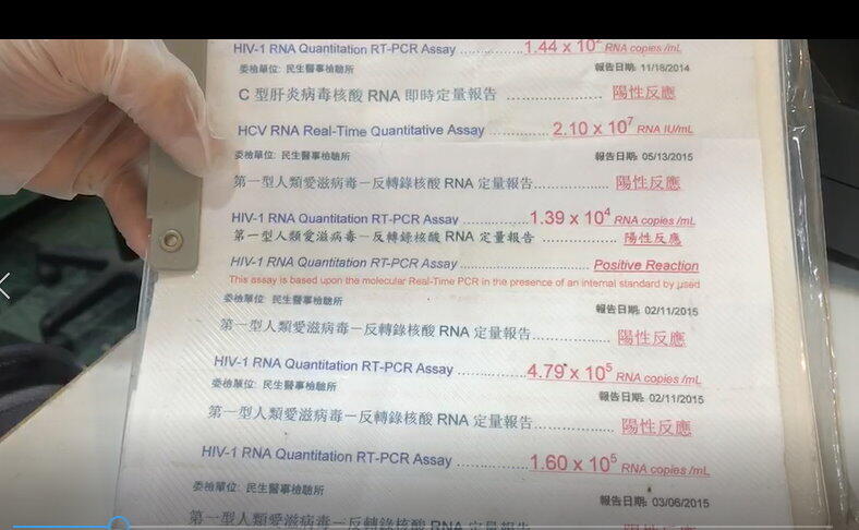 愛滋病HIV篩檢 - 北大醫事X光檢驗所 4
