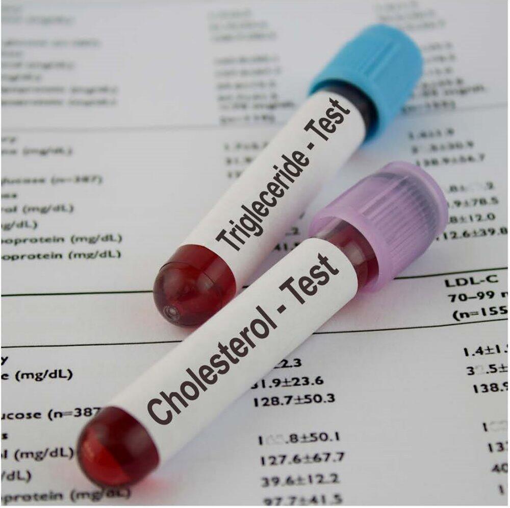 糖尿病檢測- 北大醫事X光檢驗所